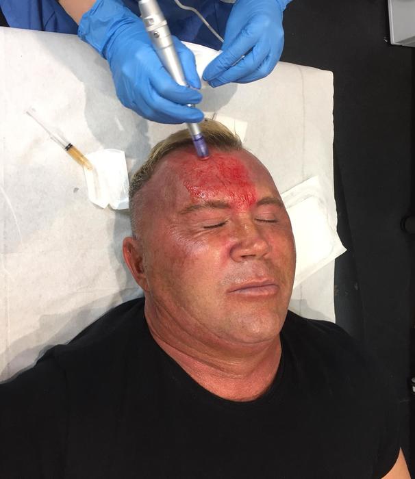 Cult celebrity facial comes to a leading Nottingham clinic straight from Hollywood